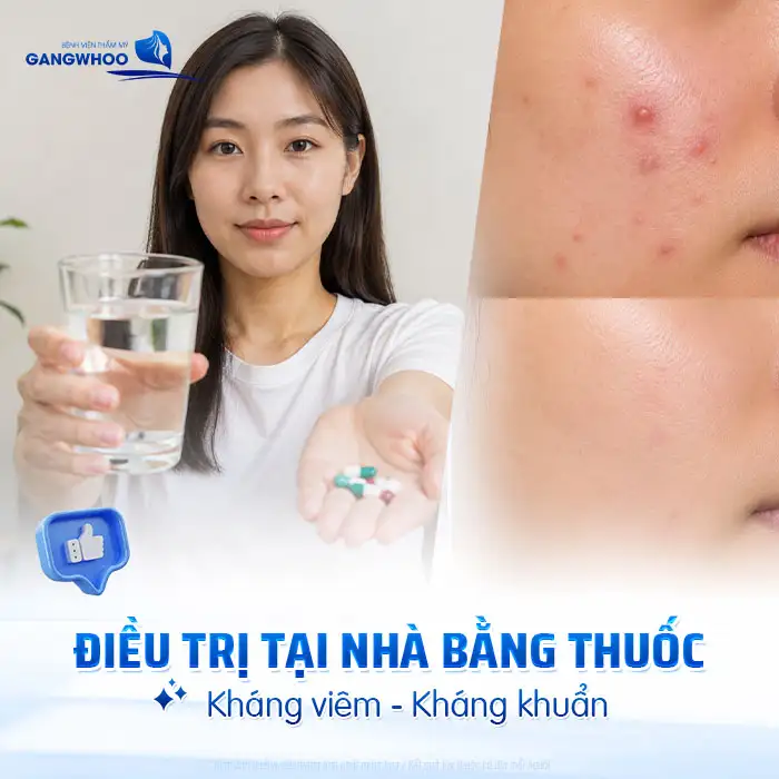 Cách điều trị mụn mủ an toàn, tránh lan rộng và nhiễm trùng