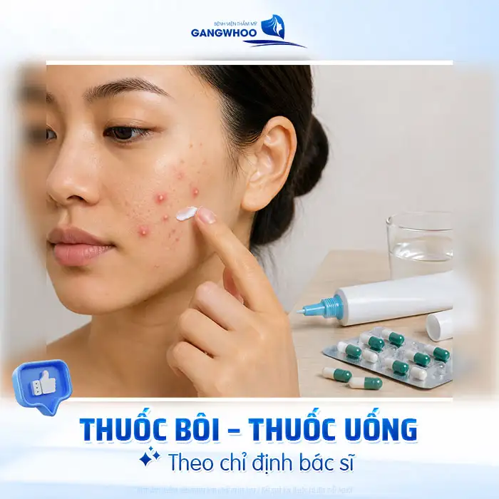 Cách điều trị mụn mủ an toàn, tránh lan rộng và nhiễm trùng