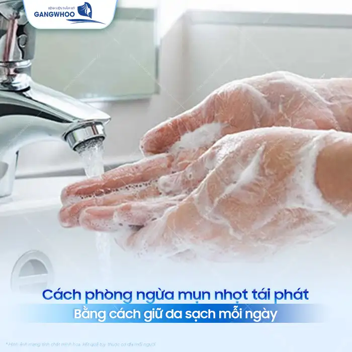 Cách điều trị mụn nhọt an toàn, hiệu quả và không để lại sẹo