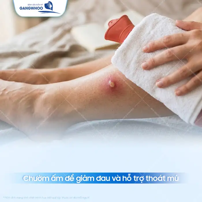 Cách điều trị mụn nhọt an toàn, hiệu quả và không để lại sẹo