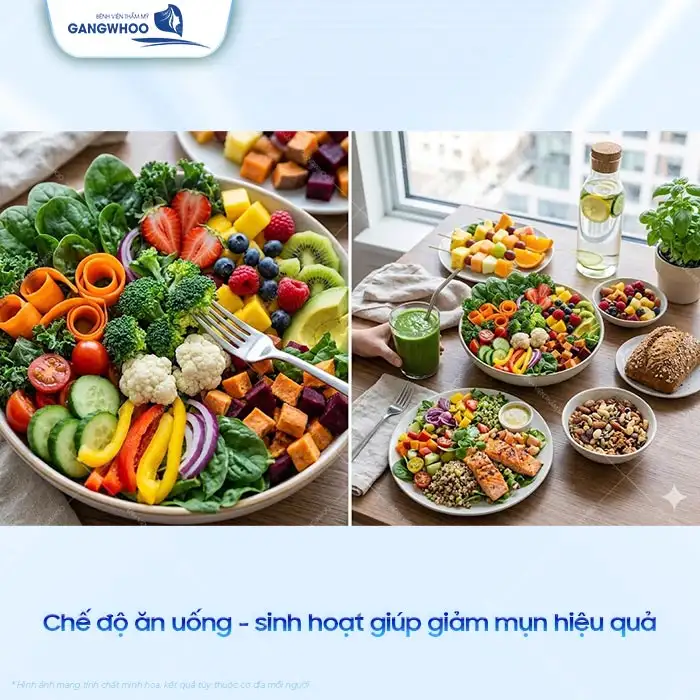 11+ Cách điều trị mụn tại nhà hiệu quả và an toàn cho da