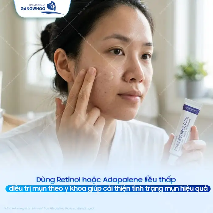 11+ Cách điều trị mụn tại nhà hiệu quả và an toàn cho da