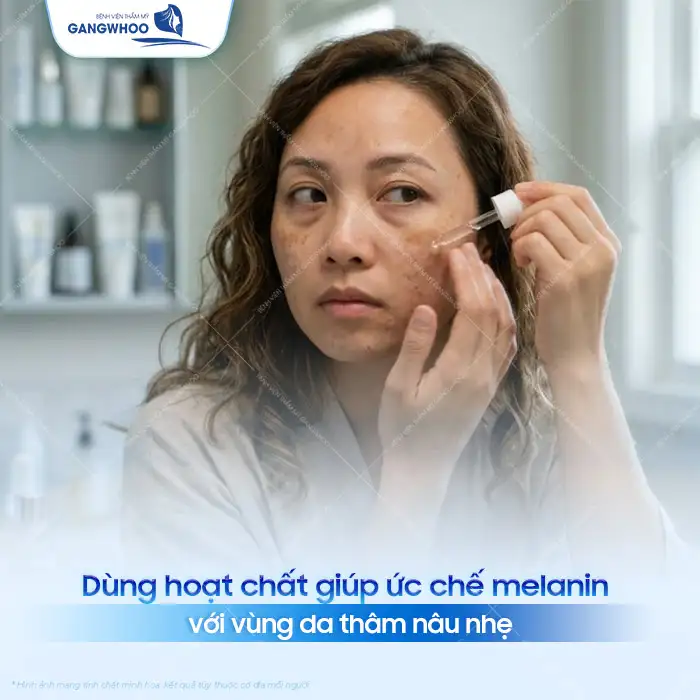 Tham khảo cách điều trị thâm mụn hiệu quả được bác sĩ khuyên dùng