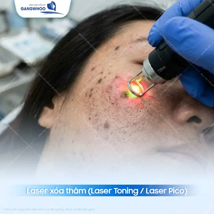 Tham khảo cách điều trị thâm mụn hiệu quả được bác sĩ khuyên dùng