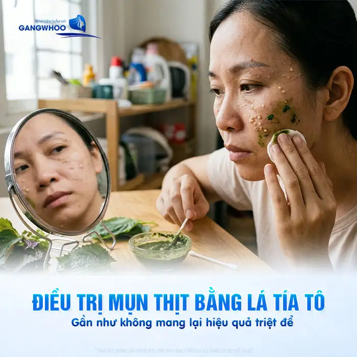 Cách điều trị mụn thịt bằng lá tía tô có hiệu quả không?
