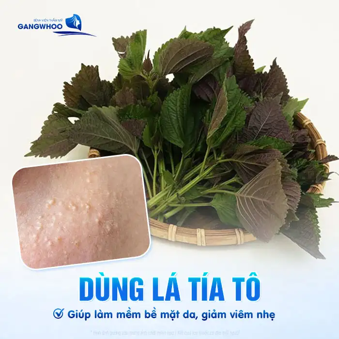 Cách điều trị mụn thịt bằng lá tía tô có hiệu quả không?