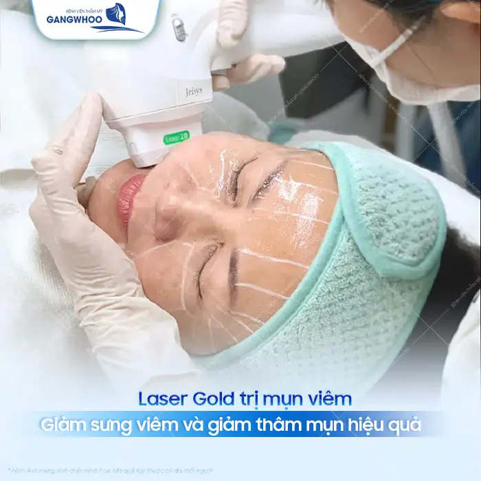 Cách điều trị mụn viêm hiệu quả, an toàn cho da mặt