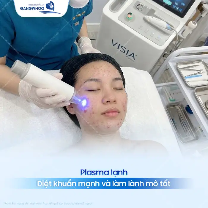 Cách điều trị mụn viêm hiệu quả, an toàn cho da mặt
