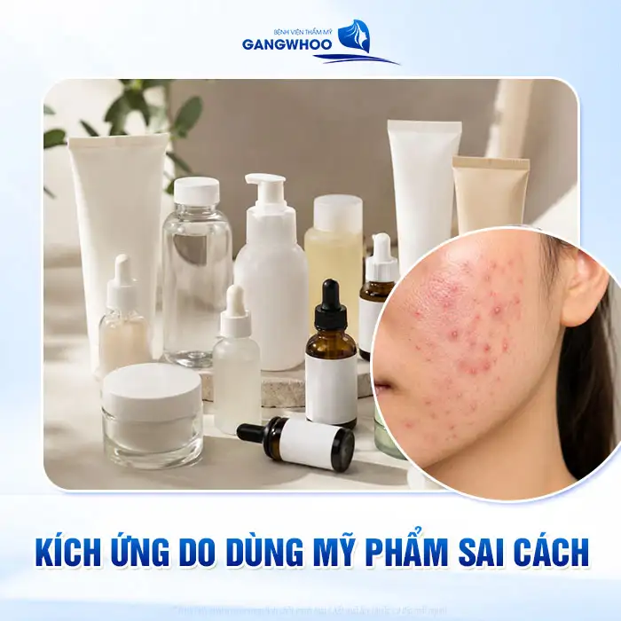 Cách điều trị phát ban mụn trứng cá an toàn và hiệu quả