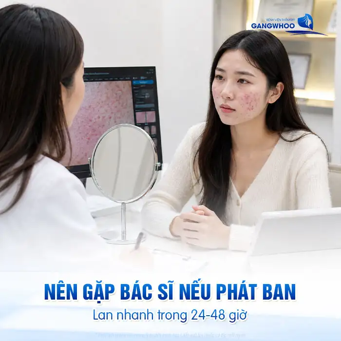 Cách điều trị phát ban mụn trứng cá an toàn và hiệu quả