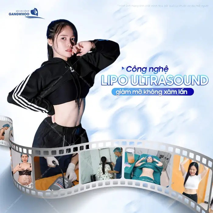 Tìm hiểu cách hút mỡ bụng hiệu quả, ít đau, giảm số đo nhanh chóng