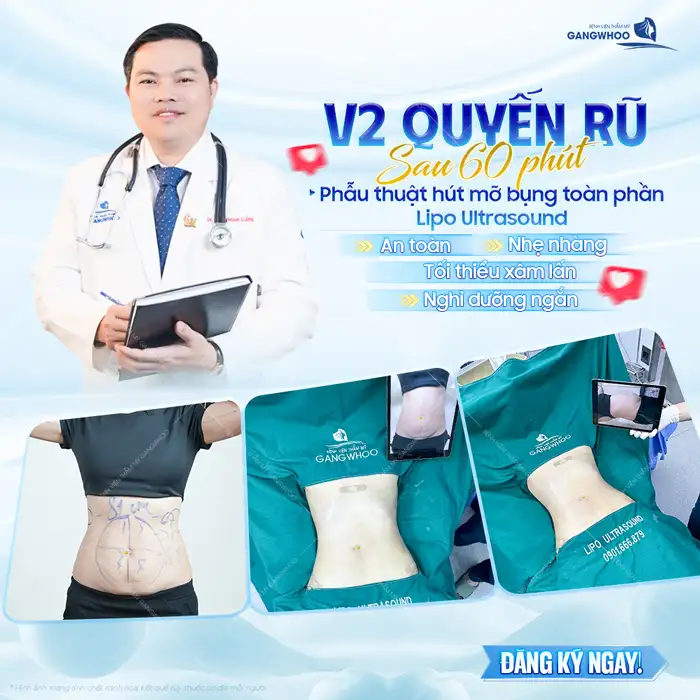 Cách hút mỡ bụng tại nhà có an toàn không? Phương pháp nào tối ưu