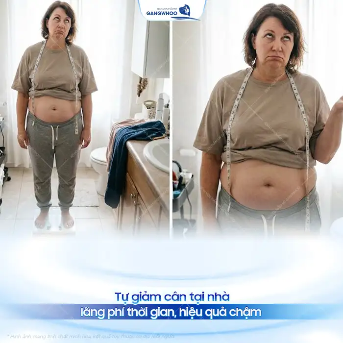 Cách hút mỡ bụng tại nhà có an toàn không? Phương pháp nào tối ưu