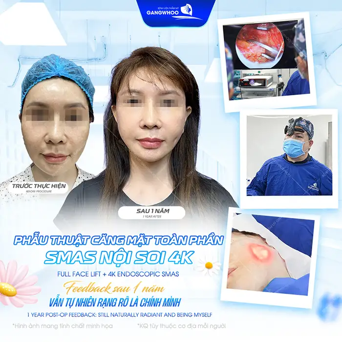 Cách làm căng da mặt sau khi giảm cân hiệu quả, an toàn