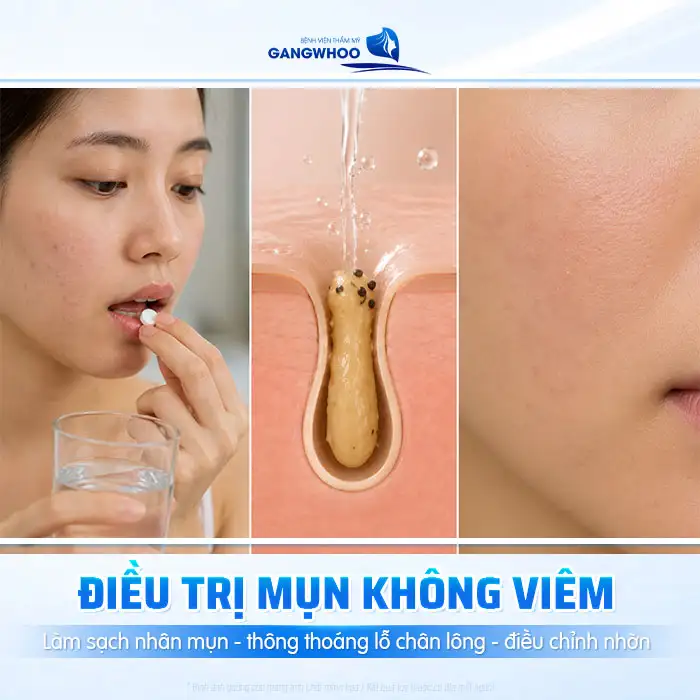 Các loại mụn và cách điều trị phù hợp cho từng tình trạng da