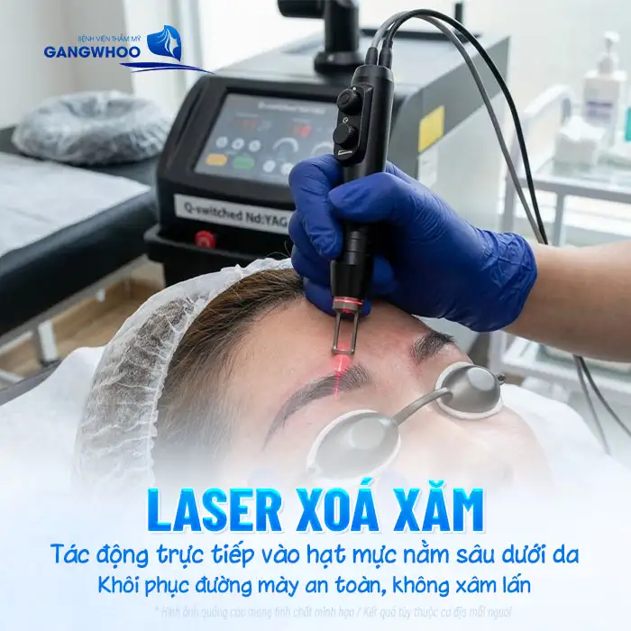 Gợi ý cách xóa xăm chân mày phun an toàn tại nhà, hiệu quả