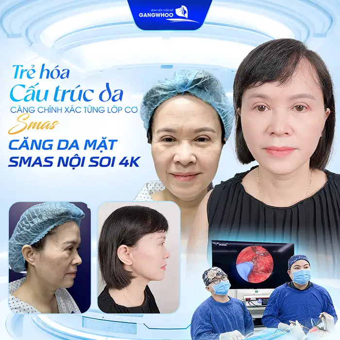 Căng chỉ da mặt giá bao nhiêu? Cập nhật bảng giá căng chỉ da mặt 2025