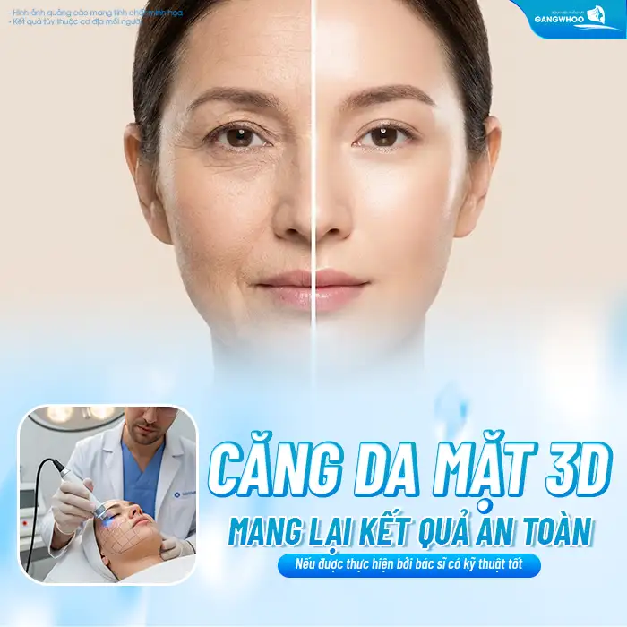 Căng da mặt 3D là gì? Phương pháp căng da mặt 3D có an toàn không?