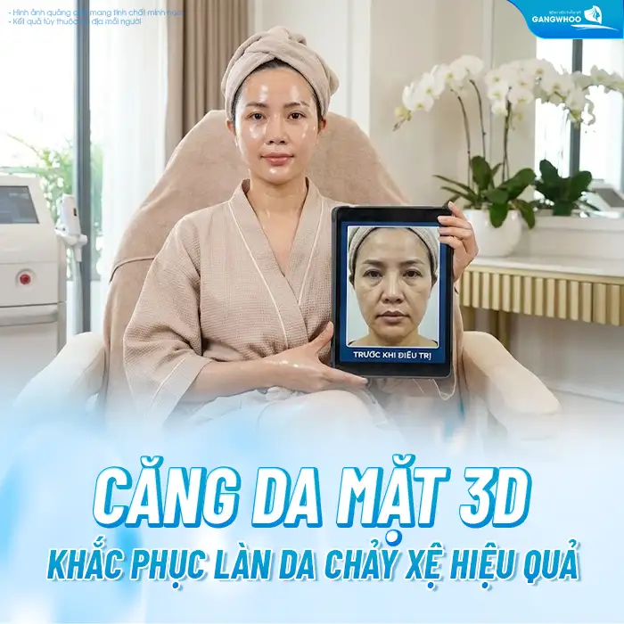 Căng da mặt 3D là gì? Phương pháp căng da mặt 3D có an toàn không?
