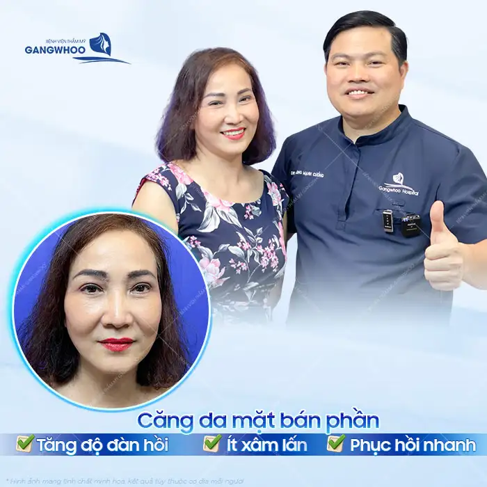 Căng da mặt bán phần là gì? Ưu, nhược điểm của căng da mặt bán phần