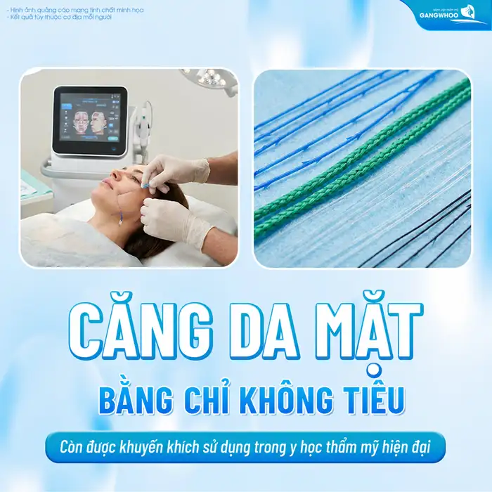 Căng da mặt bằng chỉ không tiêu có hại không? Những lưu ý khi lựa chọn