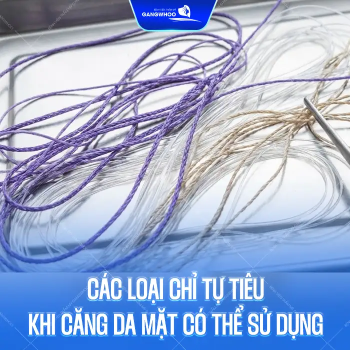 Có nên căng da mặt bằng chỉ không tiêu Hoa Kỳ? Có gây biến chứng Không?