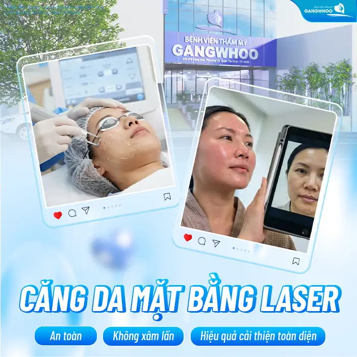 Căng da mặt bằng Laser là gì? Ưu, nhược điểm khi căng da mặt bằng Laser