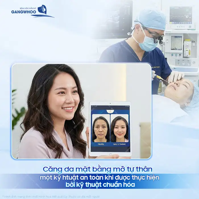 Phương pháp căng da mặt bằng mỡ tự thân là gì? Có an toàn không?