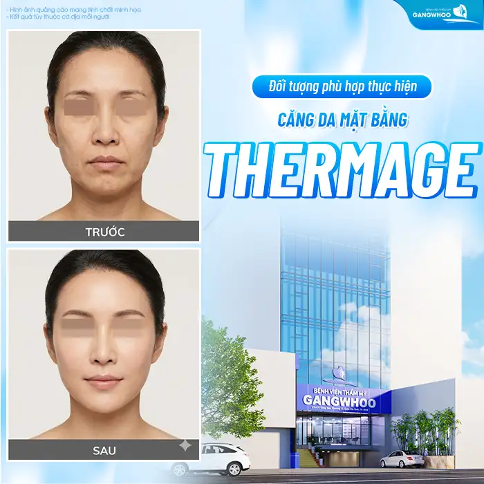 Căng da mặt bằng Thermage là gì? Căng da mặt bằng Thermage có an toàn không?