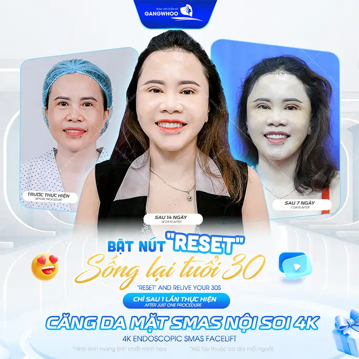 Căng da mặt có đau không? Những yếu tố gây đau sai khi căng da mặt