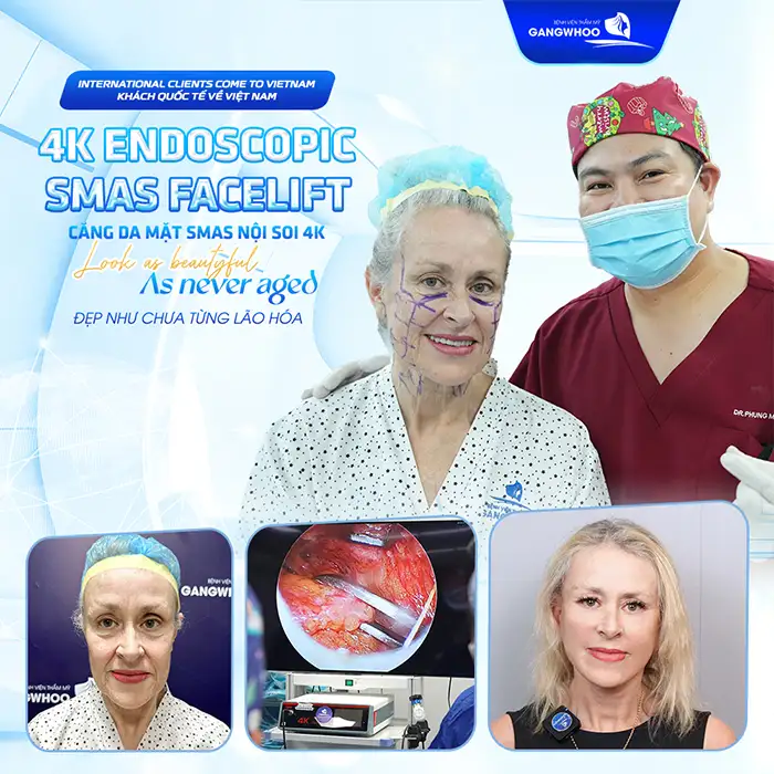 Căng da mặt giá bao nhiêu tiền? Cập nhật bảng giá mới nhất 2026