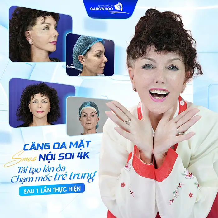 Căng da mặt nội soi giá bao nhiêu? Cập nhật bảng giá mới nhất 2026