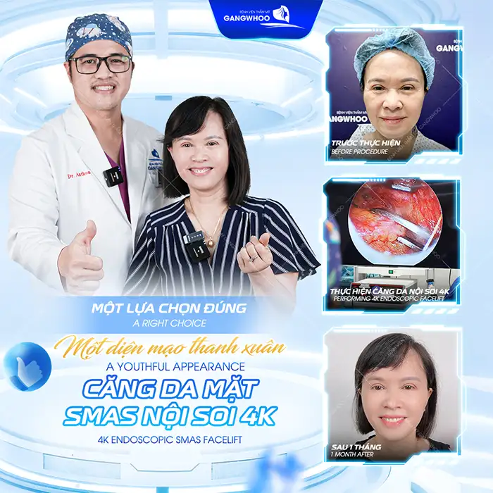 Căng da mặt ở đâu tốt? Tham khảo 7+ địa chỉ căng da mặt uy tín