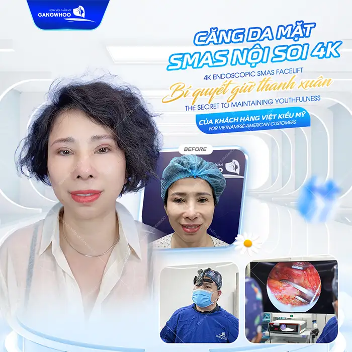 Căng da mặt ở đâu tốt? Tham khảo 7+ địa chỉ căng da mặt uy tín
