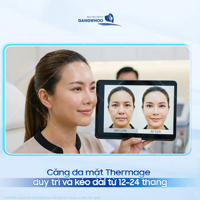 Căng da mặt Thermage được bao lâu? Cách để duy trì hiệu quả lâu dài