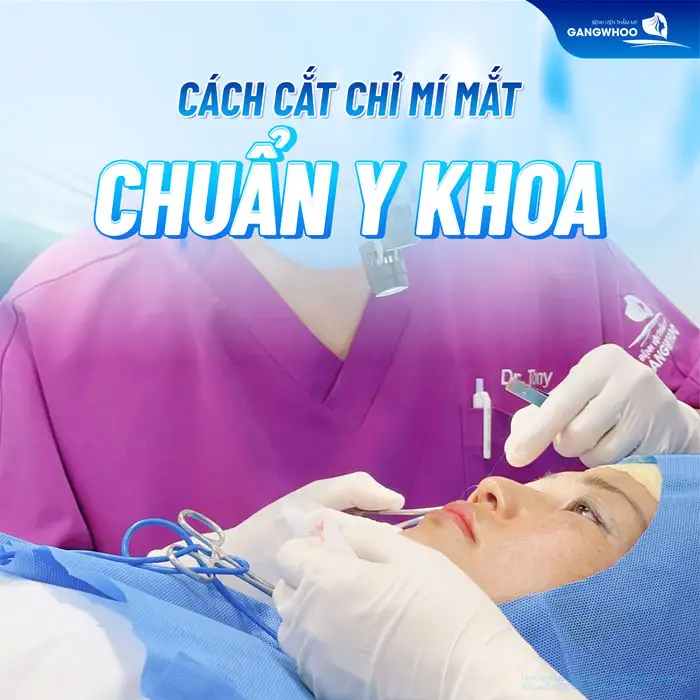 Cách cắt chỉ mí mắt chuẩn y khoa ra sao? Cách chăm sóc sau khi cắt chỉ
