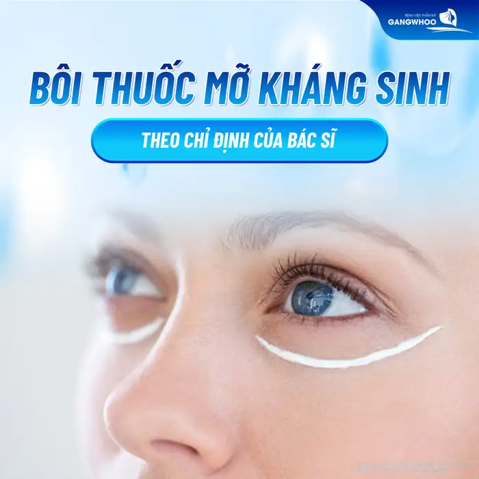 Cách cắt chỉ mí mắt chuẩn y khoa ra sao? Cách chăm sóc sau khi cắt chỉ