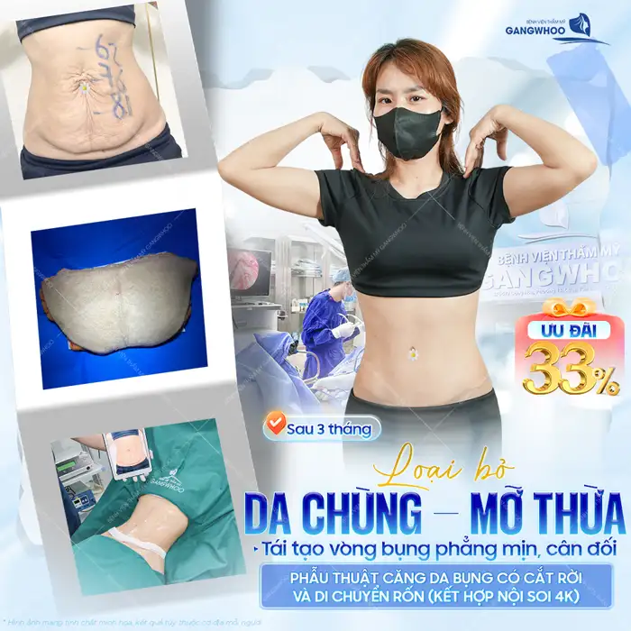 Cắt hay hút mỡ bụng tốt hơn? Phương pháp nào hiệu quả nhất