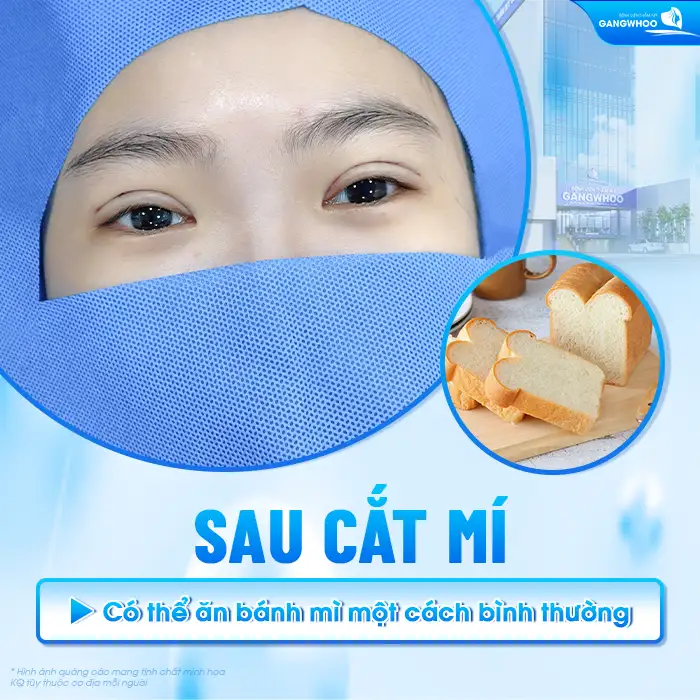 Cắt mí ăn bánh mì được không? Cần lưu ý gì khi ăn bánh mì?