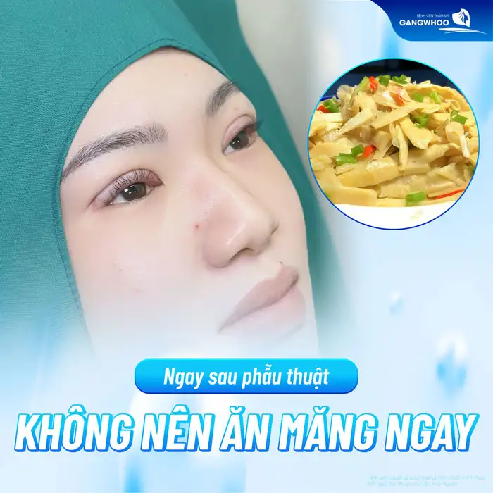 Cắt mí ăn măng được không? Có ảnh hưởng đến vết thương không?