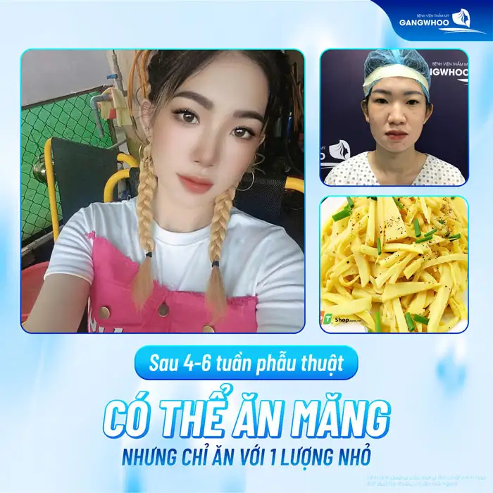 Cắt mí ăn măng được không? Có ảnh hưởng đến vết thương không?