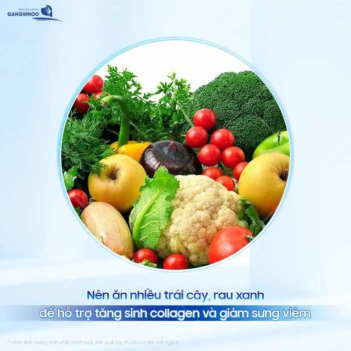 Sau cắt mí ăn mực được không? Sau bao lâu thì mới được ăn mực?