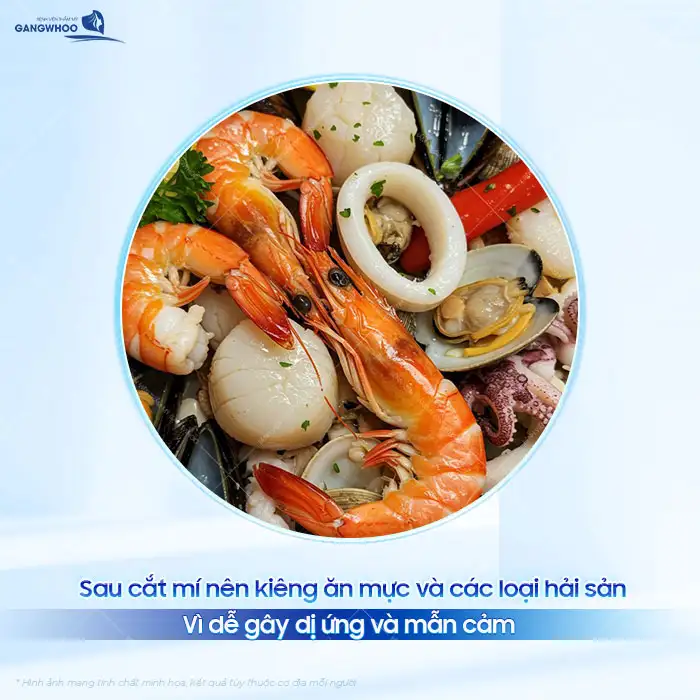 Sau cắt mí ăn mực được không? Sau bao lâu thì mới được ăn mực?