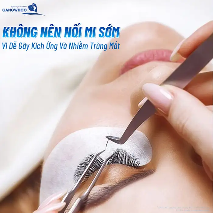 Cắt mí bao lâu thì được nối mi? Những lưu ý khi nối mi sau cắt mí