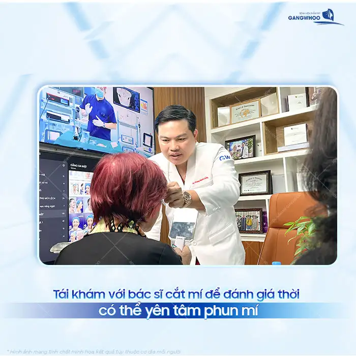 Cắt mí bao lâu thì phun mí được? Thời điểm nào thích hợp để phun mí