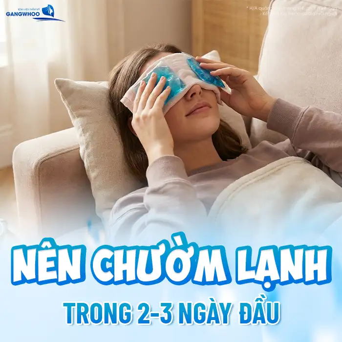 Cắt mí bị bầm phải làm sao? Cách xử lý khi cắt mí mắt bị bầm tím