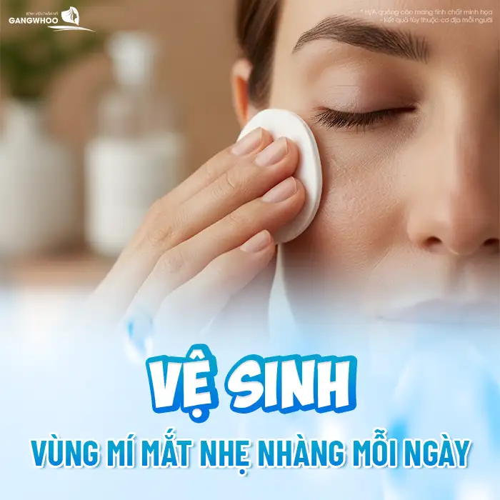 Cắt mí bị bầm phải làm sao? Cách xử lý khi cắt mí mắt bị bầm tím