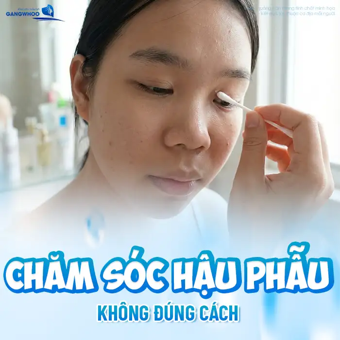 Nguyên nhân cắt mí bị lật mi là gì? Cách khắc phục ra sao?