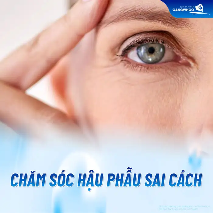 Cắt mí mắt bị sẹo lồi cần xử lý ra sao? Nguyên nhân do đâu?