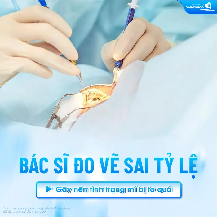 Cắt mí bị to quá có sửa được không? Nguyên nhân do đâu?